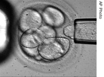 In this photo made available by Advanced Cell Technology, a single cell is removed from a human embryo to be used in generating embryonic stem cells for scientific research