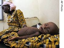 Firdaoussi Saadou a ten-month-old girl who weighs 3.2 kilograms  suffering from malnutrition lies in the hospital in Maradi, Niger 
