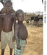 Malnourishment in Niger 
