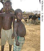 Malnourishment in Niger