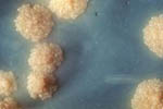 Mycobacterium tuberculosis colonies