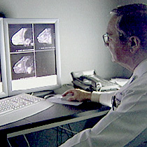 Nearly 14 percent of breast cancer patients without a family history of breast cancer tested positive for the mutated gene