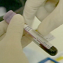 Doctors diagnose about 15,000 from children ages 10 to 14 with type one diabetes