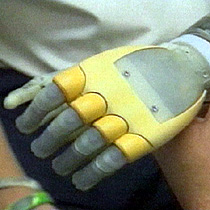 The artificial hand is controlled in the same way as a real hand: brain power and muscles