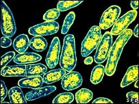 Electron microscope image of XDR-TB bacteria